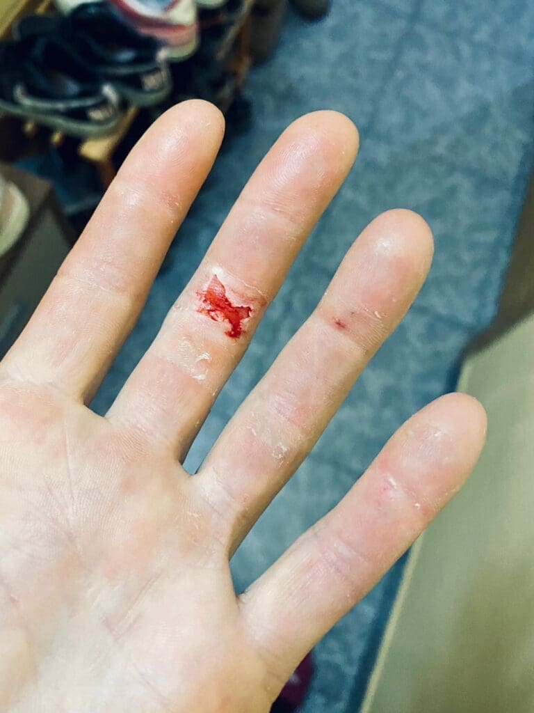 Climber hands and skin: How to look after them